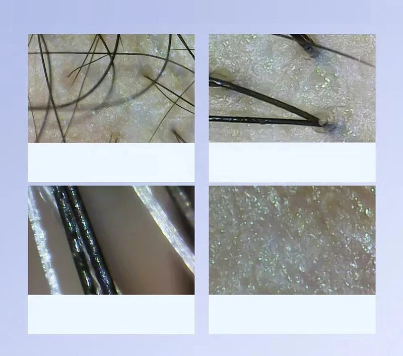 Digital Scalp Skin Analyzer Microscope – Electronic Pore Detection Camera for Hair and Skin Analysis