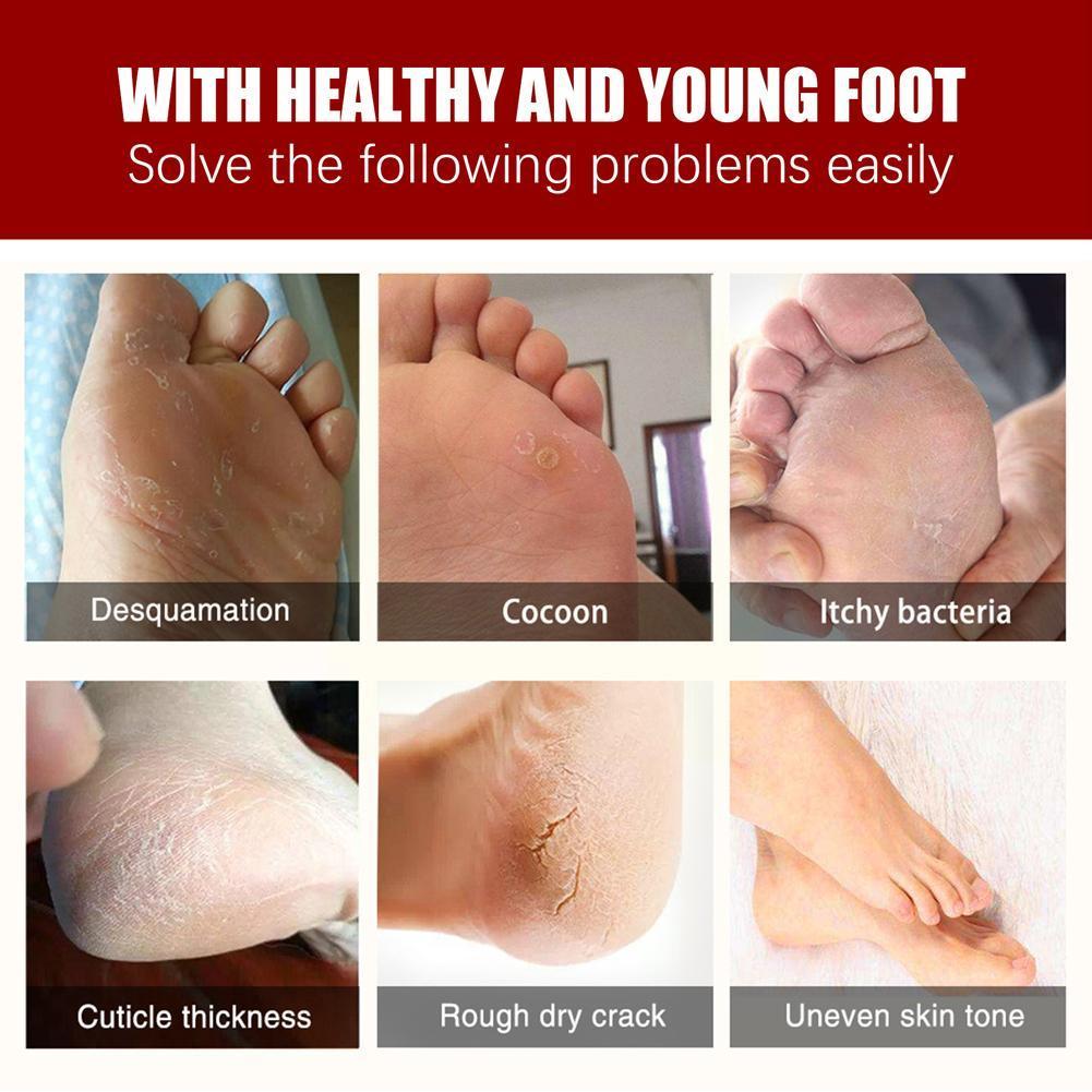 Exfoliating Foot Mask - Unlock the Secret to Soft, Beautiful Feet