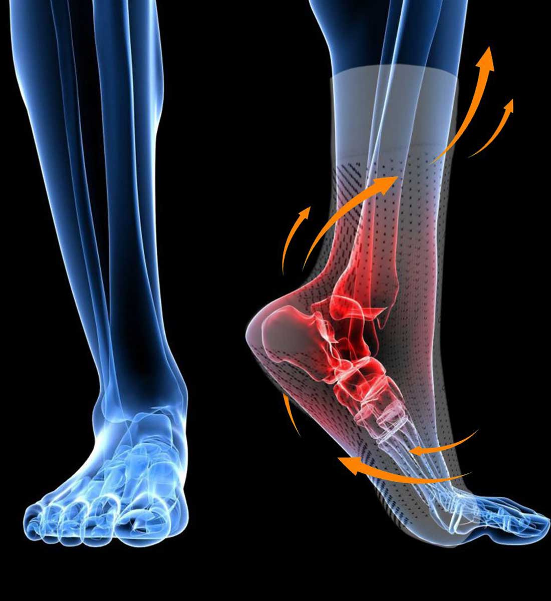 Soothrelieve Food Relief Compression Socks