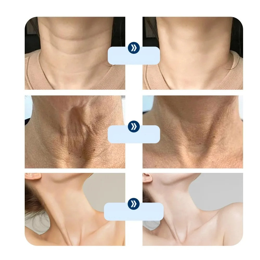 LED Neck Lift Mask Device – Anti-Wrinkle Photon Therapy Skin Tightening Beauty Tool for Rejuvenation, Firming & Neckline Care