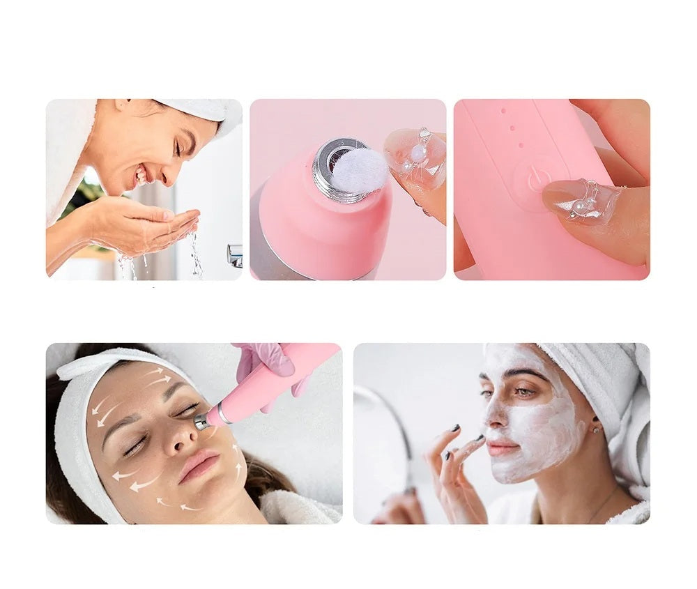 Diamond Microdermabrasion Facial Device - Portable Exfoliation Vacuum for Deep Cleaning, Blackhead Removal, and Glowing Skin Care