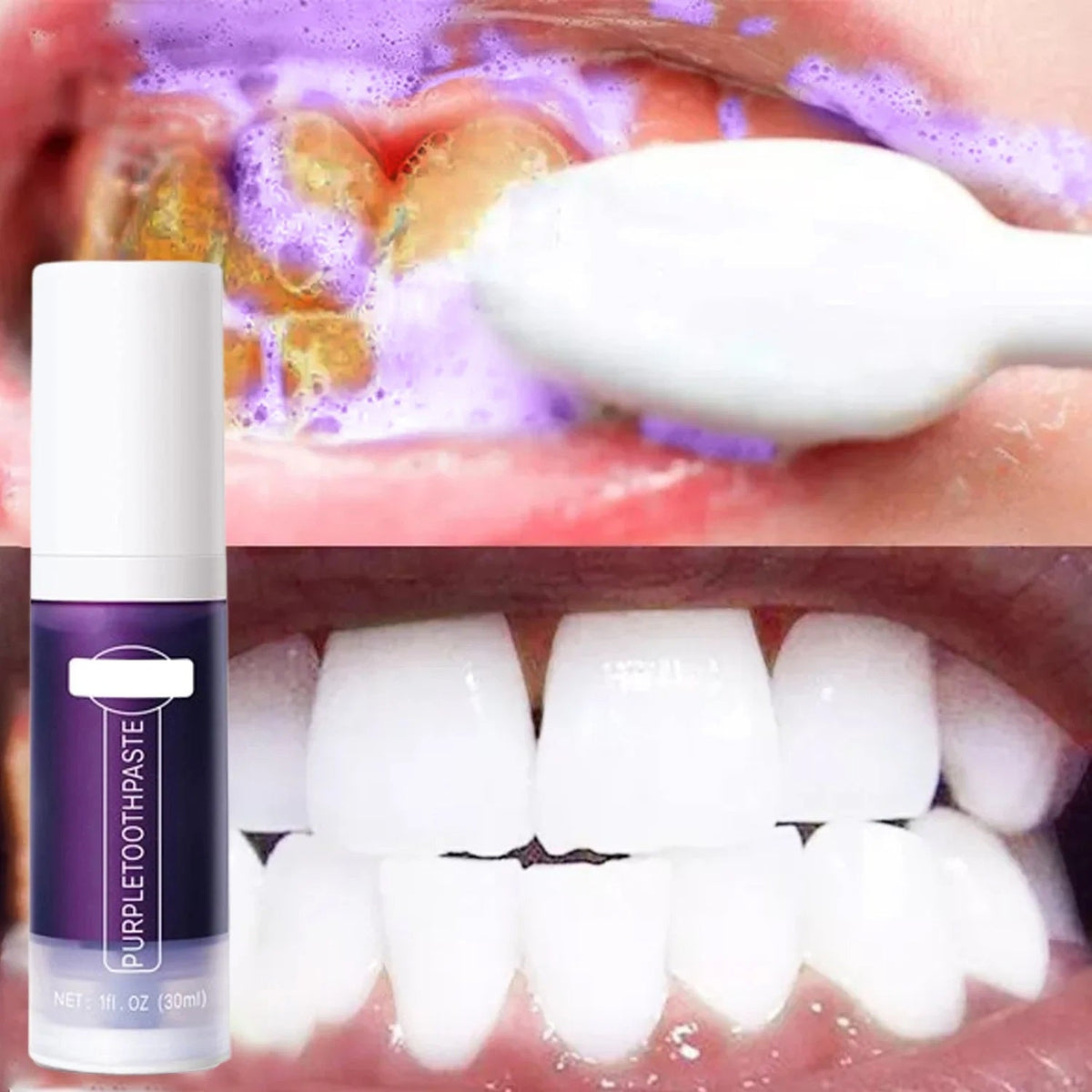 Teeth Whitening Toothpaste – 5D Pro-Grade Whitening Strips & Fresh Breath Oral Care