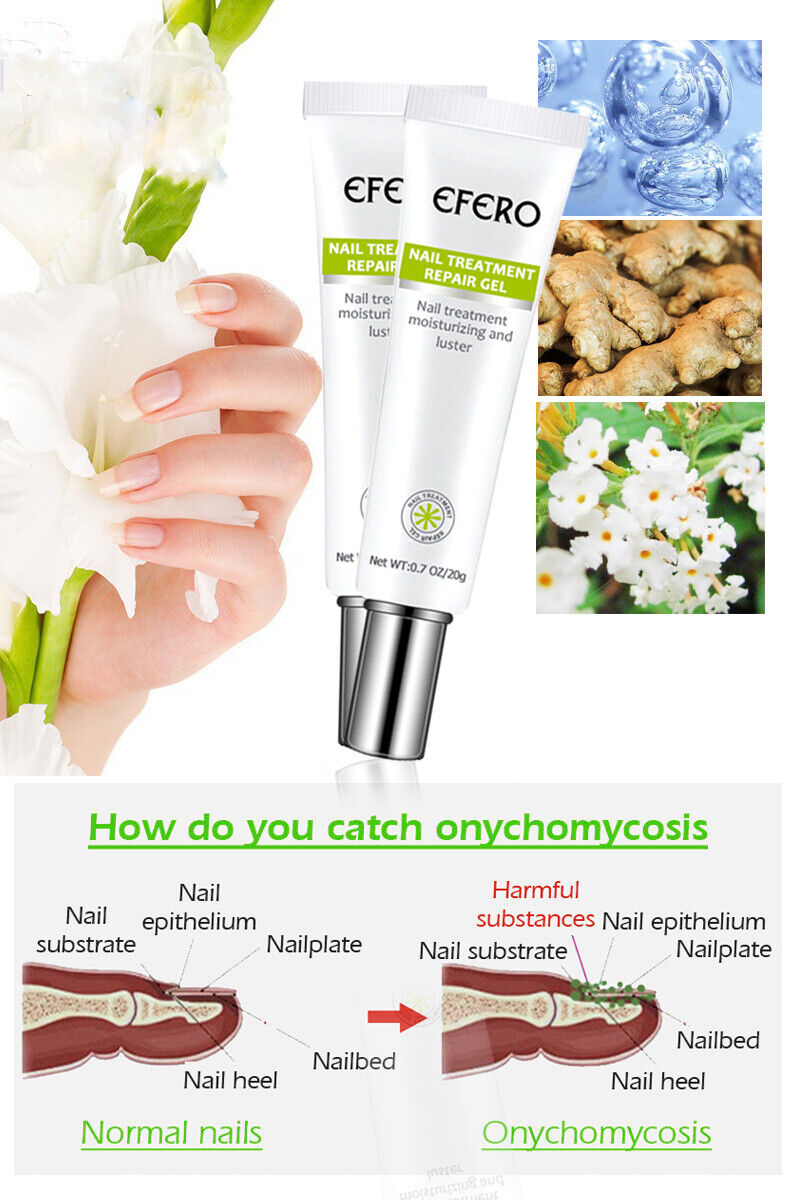 Nail Repair Treatment Gel
