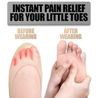 Silicone Anti-Friction Toe Protectors