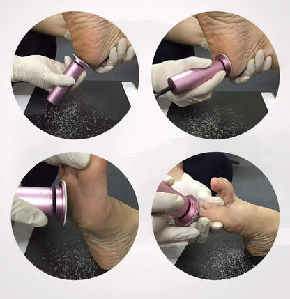 Electric Pedicure Foot Callus Remover – Gently Exfoliates Dead Skin, Cracked Heels & Dry Feet for Silky Smooth Finish