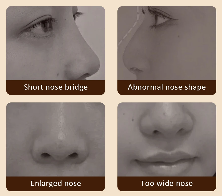 Ultrasonic Nose Lifting Massage Device – Reduces Nasal Swelling, Clears Sinuses, and Lifts Facial Contours with Hot Compress Therapy
