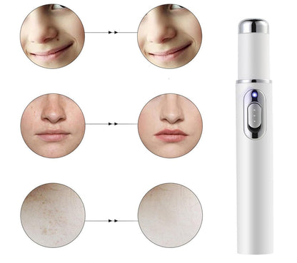 Scar Removal Phototherapy Pen – Asia’s Best-Selling Expert-Recommended Device for Fading Old Scars & Stretch Marks