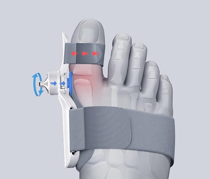 Electric Bunion Straightener with Vibration Massage - Airbag Toe Separator for Hallux Valgus Correction and Comfortable Alignment