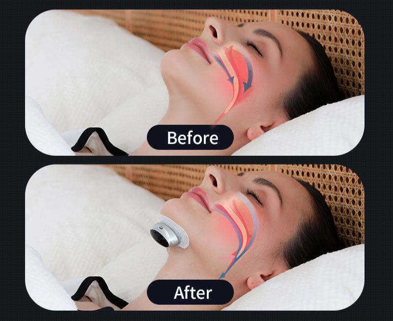 VernSleep Smart Sleep Apnea Aid