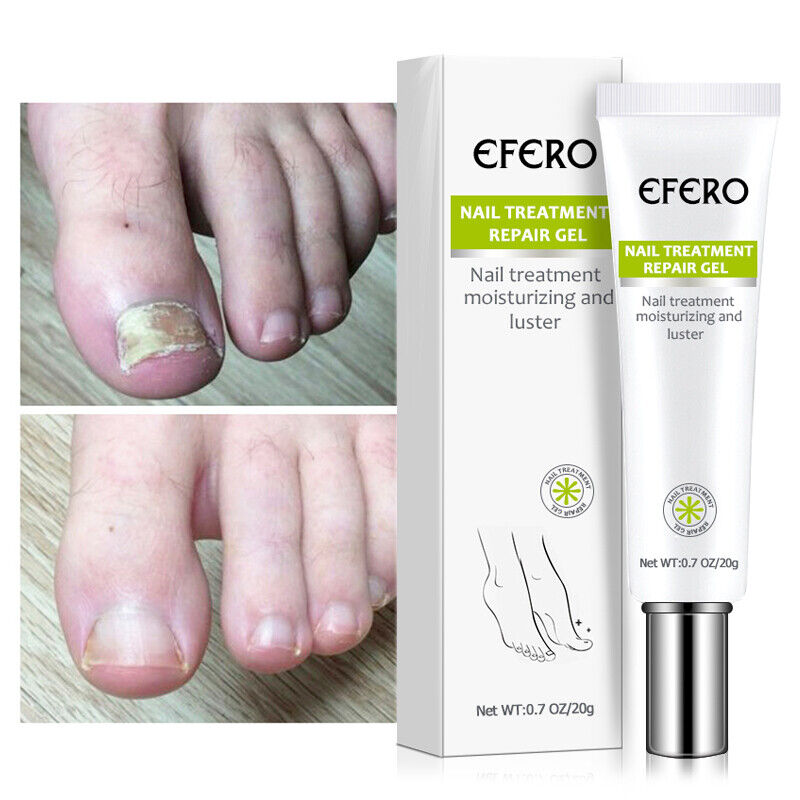 Nail Repair Treatment Gel