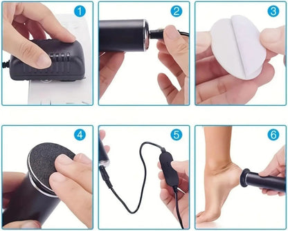 Electric Pedicure Foot Callus Remover – Gently Exfoliates Dead Skin, Cracked Heels & Dry Feet for Silky Smooth Finish