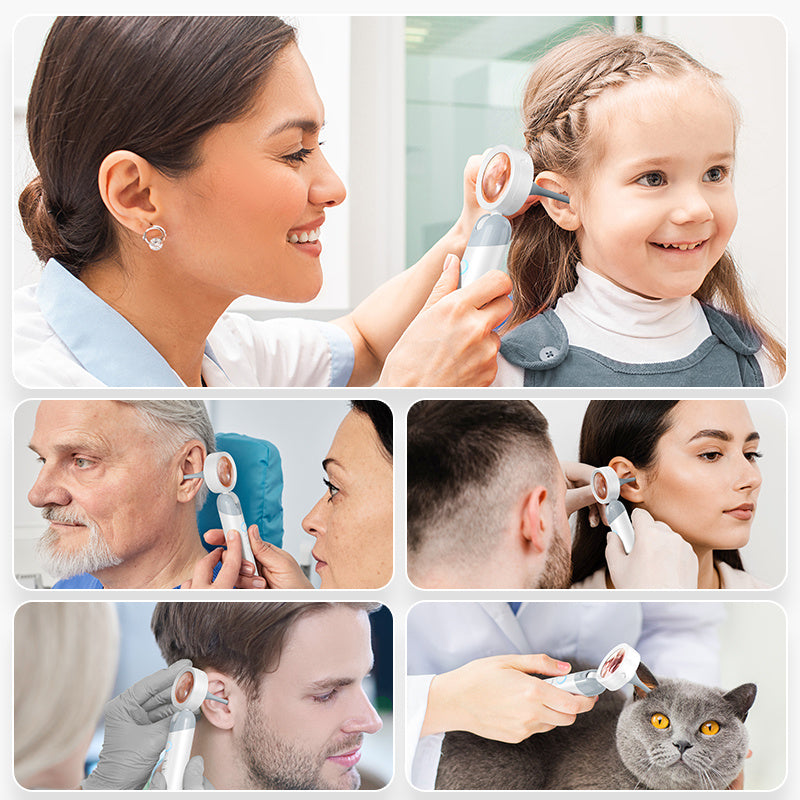 Smart Ear and Nose HD Camera – 4-in-1 High-Definition Inspection Tool with Wax Removal Kit for Safe, Easy Cleaning