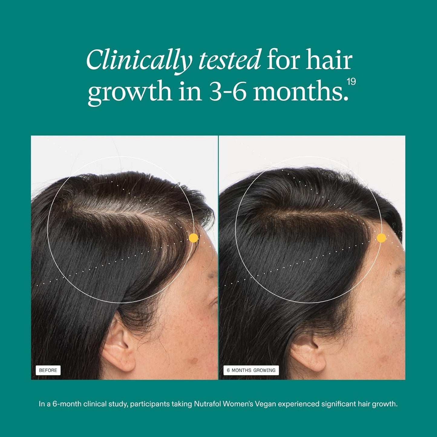 Nutrafol Women's Hair Growth