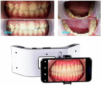 Universal Dental Photography LED Light – Intraoral Oral Filling Flashlight Lamp for Dentist Treatment and Clinical Imaging