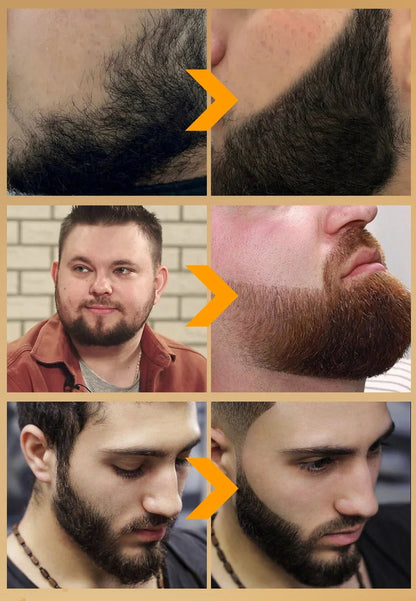 Beard Filler Pen & Brush Set – Waterproof Beard Enhancer for Moustache Definition, Shape, and Lasting Hair Line Repair