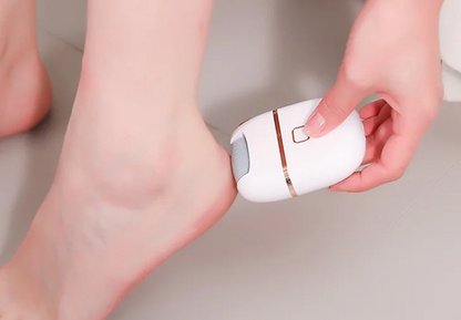 Electric Foot Scraper with 3 Grinding Heads – Two-Speed Callus Remover for Soft Feet, Powerful Rechargeable Tool for Home Pedicure Routine