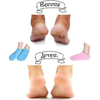 Moisturizing Socks with Spa Gel Lining