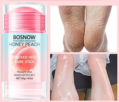 Hypoallergenic Foot & Hand Care Stick – 40g Plant Extract Formula with Aloe Vera, Rosemary, Chamomile & Vitamin C for Deep Moisturizing and Nourishment