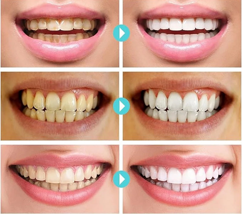 Mineral Teeth Whitening Powder – 50g Oral Care Formula to Clean Stains, Brighten Smile, and Restore Natural Fresh Breath Confidence