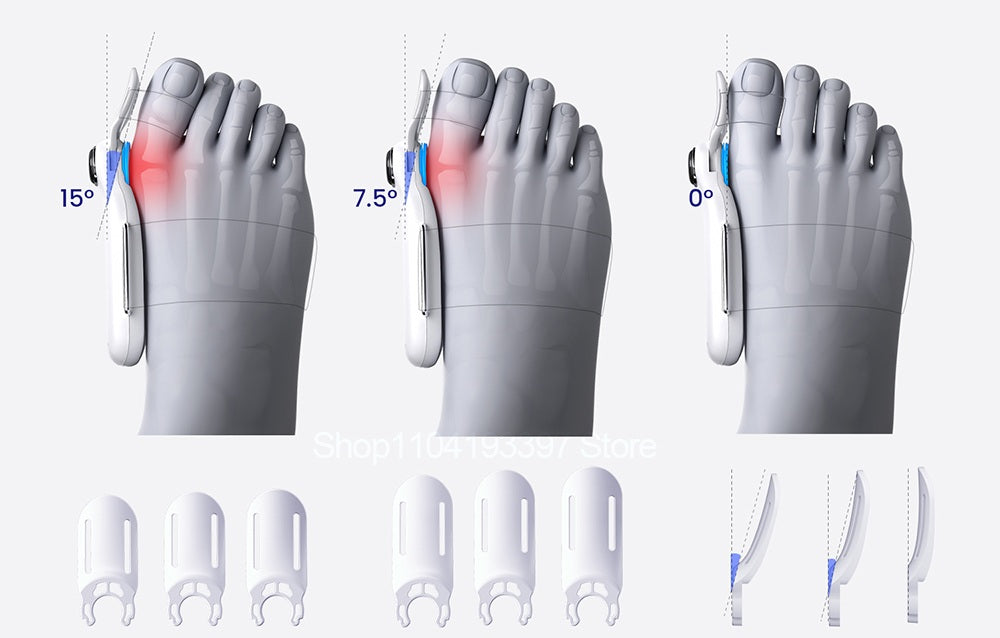 Electric Bunion Straightener with Vibration Massage - Airbag Toe Separator for Hallux Valgus Correction and Comfortable Alignment