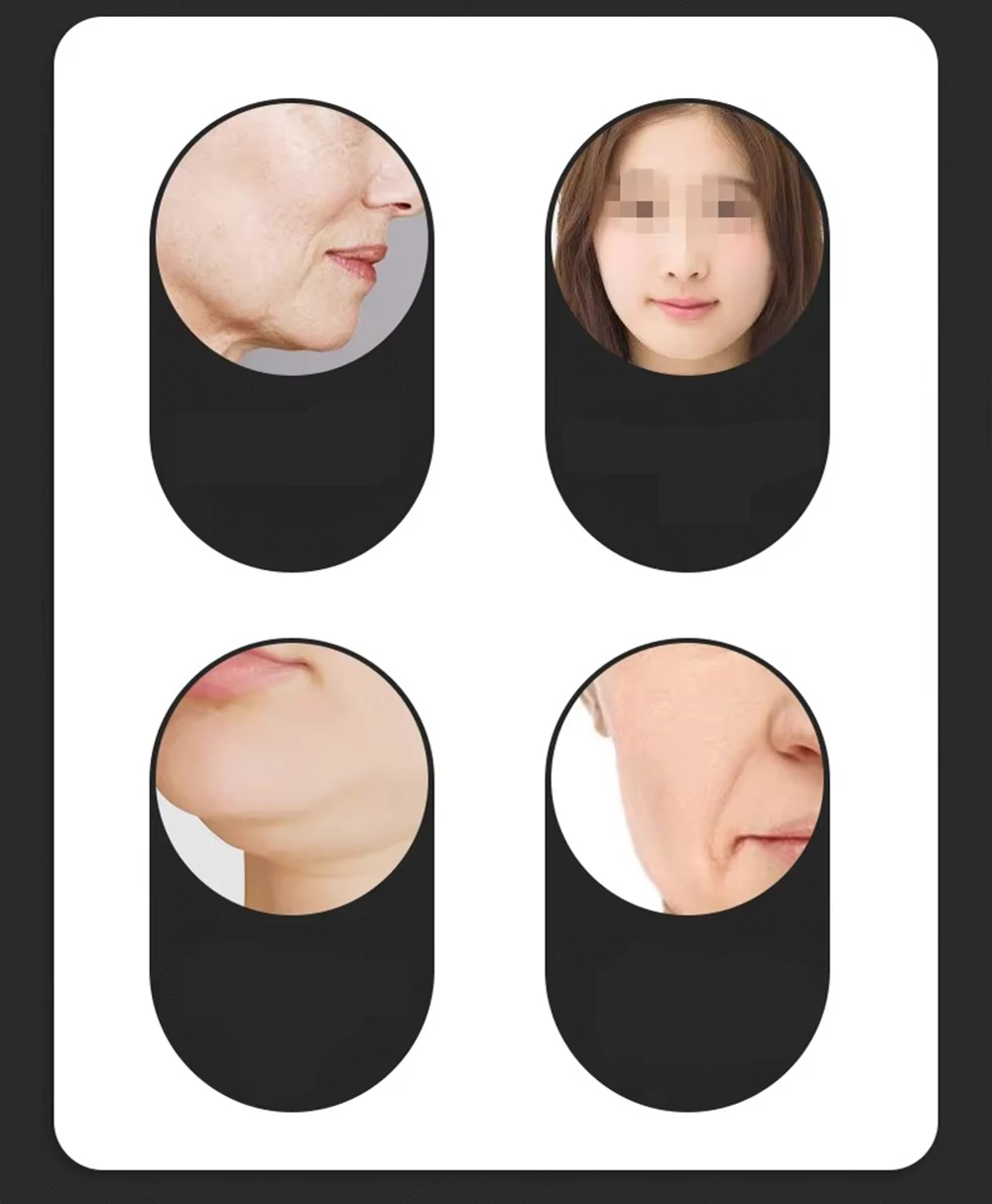 Smart V-Face Slimming EMS Mask – Electric Face Lift Device with Remote Control for Contouring, Tightening, and Skin Rejuvenation