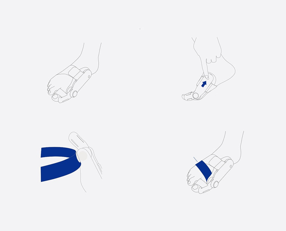 Electric Bunion Straightener with Vibration Massage - Airbag Toe Separator for Hallux Valgus Correction and Comfortable Alignment