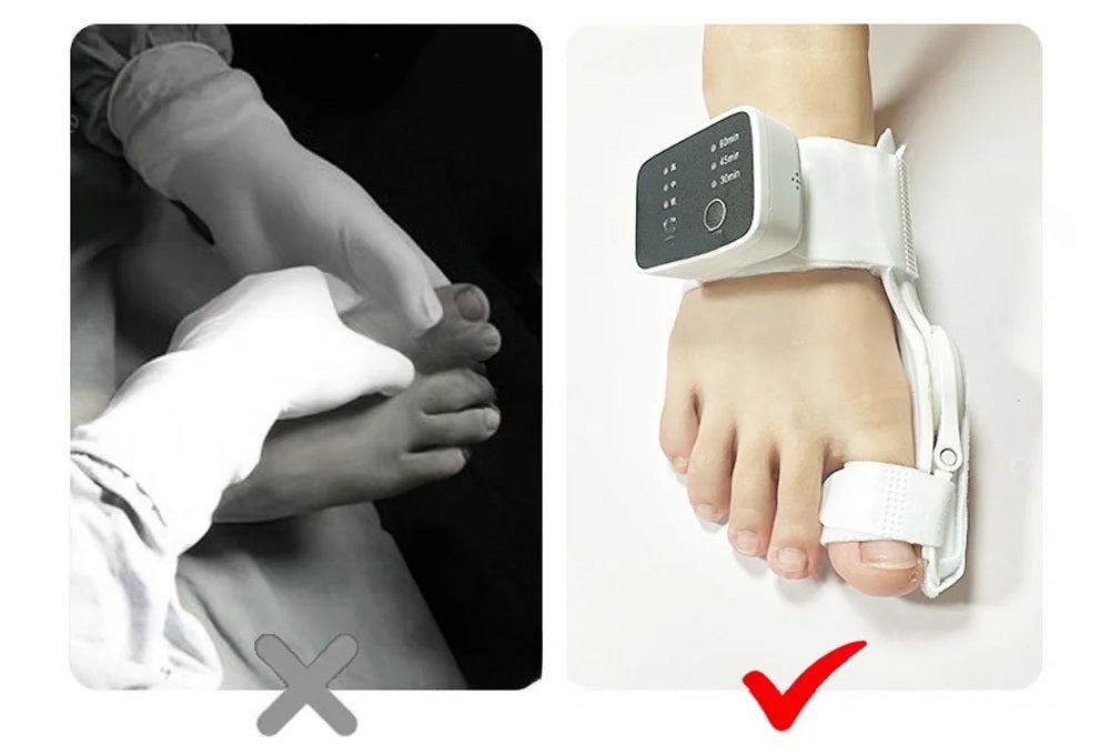 Electric Bunion Corrector – Vibration Massager with Adjustable Brace for Hallux Valgus Relief, Toe Straightening, and Foot Care