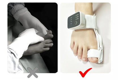 Electric Bunion Corrector – Vibration Massager with Adjustable Brace for Hallux Valgus Relief, Toe Straightening, and Foot Care