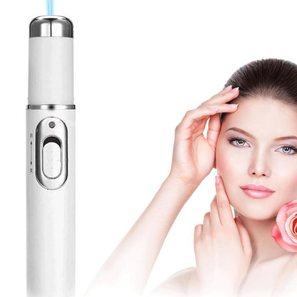 Blue Light Therapy Care Pen – Gentle Skin Treatment Device to Reduce White Spots with Safe Comfortable Daily Use