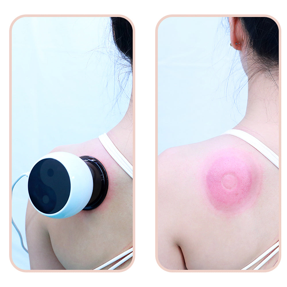 Smart Electric Cupping Massager – Vacuum Therapy Device with Remote Control for Deep Muscle Relief and Body Recovery