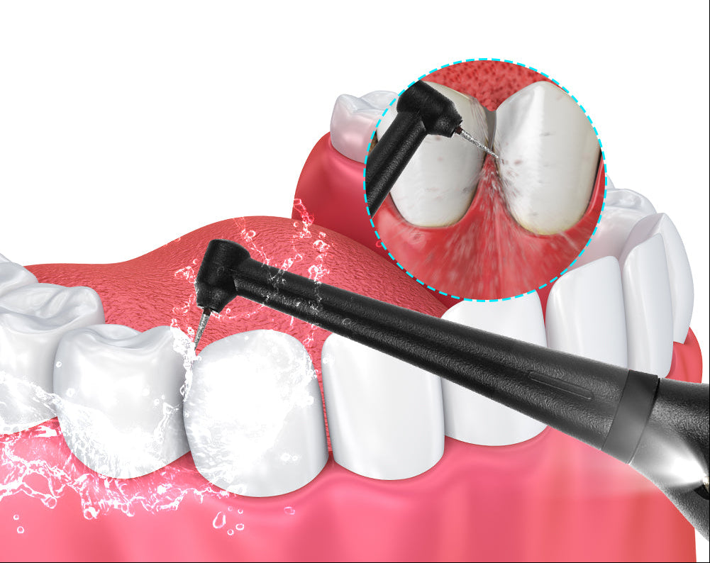 Electric Tooth Cleaning Device – 5-Speed Adjustable Oral Care Tool for Convenient At-Home Dental Cleaning, Polishing and Everyday Hygiene Routines