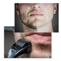 Dermal Roller For Hair And Beard Growth