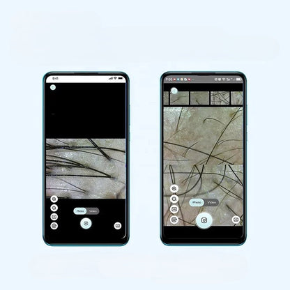 Digital Scalp Skin Analyzer Microscope – Electronic Pore Detection Camera for Hair and Skin Analysis