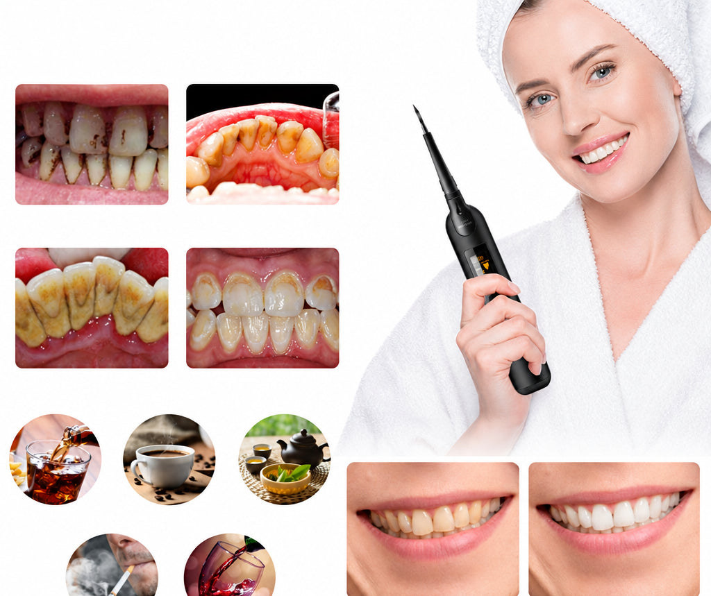 Electric Tooth Cleaning Device – 5-Speed Adjustable Oral Care Tool for Convenient At-Home Dental Cleaning, Polishing and Everyday Hygiene Routines