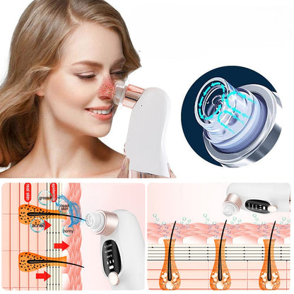 Electric Blackhead Remover Vacuum – Facial Pore Cleaner Tool for Acne, Black Dots and Deep Skin Cleansing