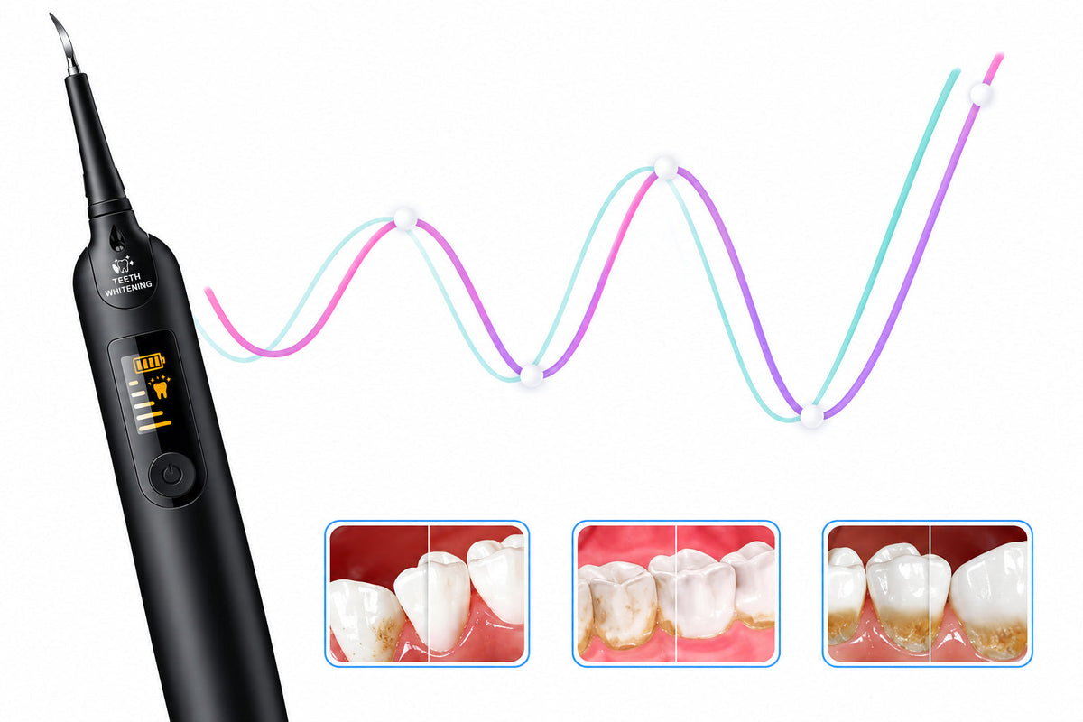 Electric Tooth Cleaning Device – 5-Speed Adjustable Oral Care Tool for Convenient At-Home Dental Cleaning, Polishing and Everyday Hygiene Routines