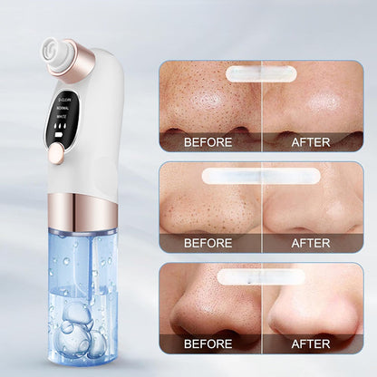 Electric Blackhead Remover Vacuum – Facial Pore Cleaner Tool for Acne, Black Dots and Deep Skin Cleansing