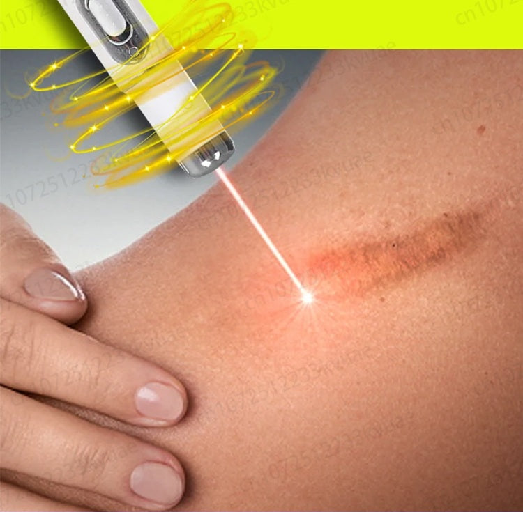 Scar Removal Phototherapy Pen – Asia’s Best-Selling Expert-Recommended Device for Fading Old Scars & Stretch Marks