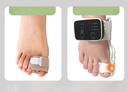 Electric Bunion Corrector – Vibration Massager with Adjustable Brace for Hallux Valgus Relief, Toe Straightening, and Foot Care