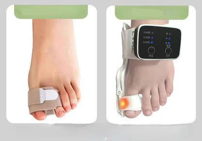 Electric Bunion Corrector – Vibration Massager with Adjustable Brace for Hallux Valgus Relief, Toe Straightening, and Foot Care