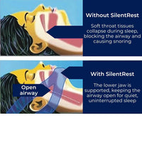 Full Head Chin Strap for Snoring Relief | Sleep Apnea Support - Comfortable - Night Use