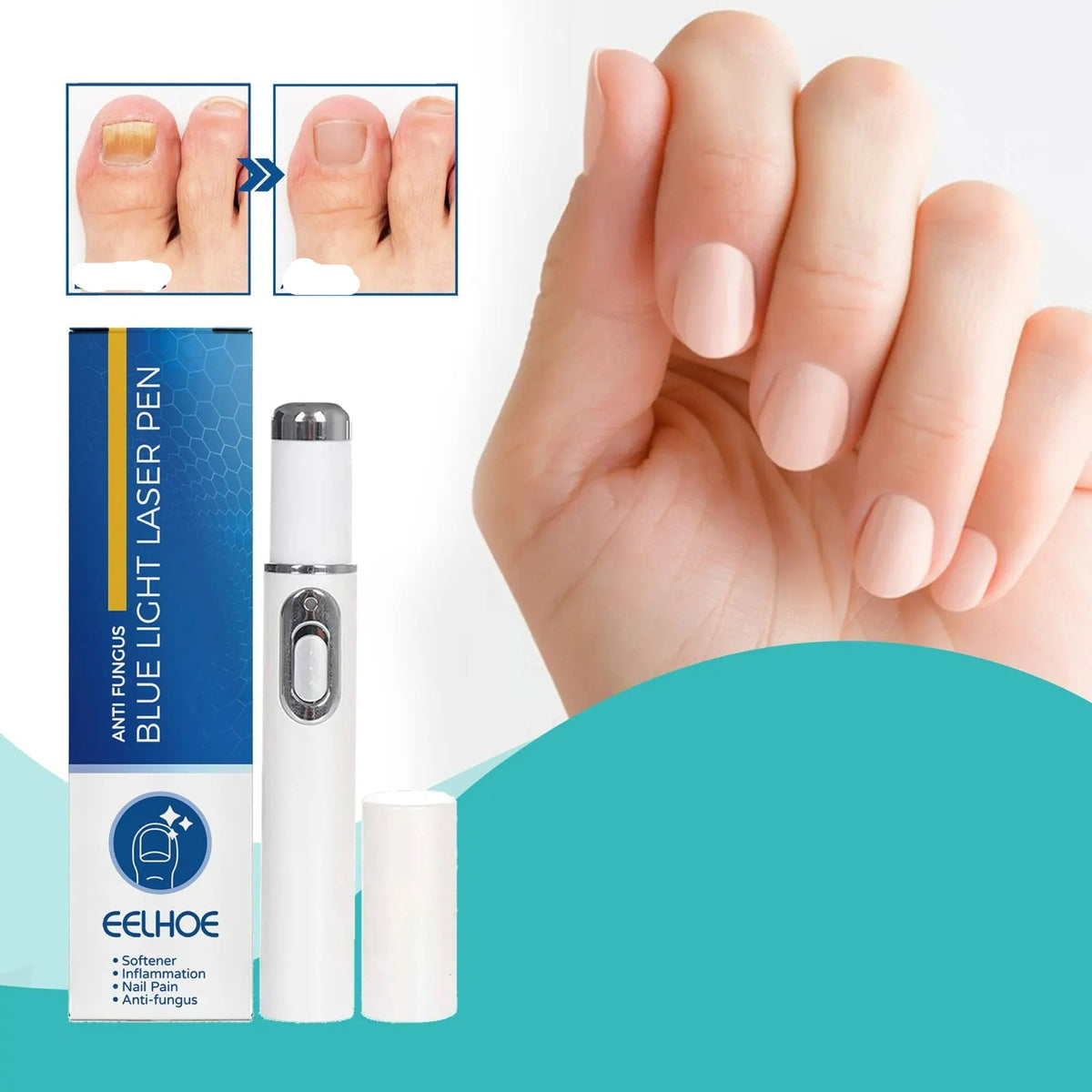 Antifungal Laser Device - Nail Fungus Treatment Pen Anti-fungal Repair Pen Blue Light Laser Pen