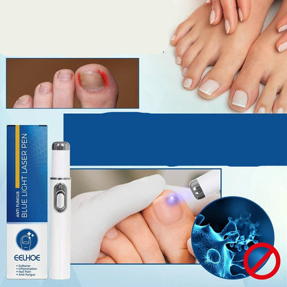 Antifungal Laser Device - Nail Fungus Treatment Pen Anti-fungal Repair Pen Blue Light Laser Pen