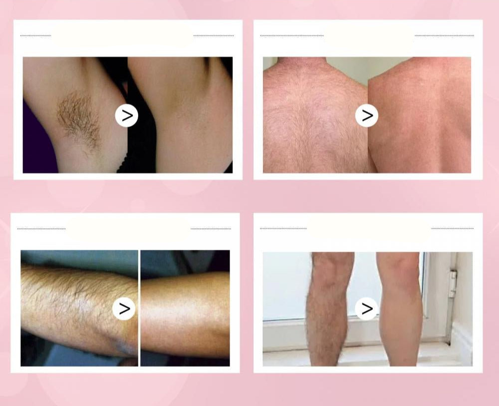 Beeswax Hair Removal Mousse - Painless Hair Removal Cream