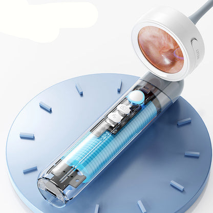 Smart Ear and Nose HD Camera – 4-in-1 High-Definition Inspection Tool with Wax Removal Kit for Safe, Easy Cleaning