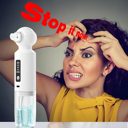 Blackhead Remover Vacuum – 6 Head Electric Pore Cleaner with USB Rechargeable Suction for Deep Cleaning, Acne Removal, and Gentle Exfoliation at Home
