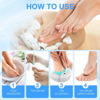 Nail Fungus Laser