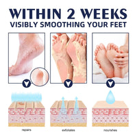 Cracked Foot Heel Treatment 3 Pack
