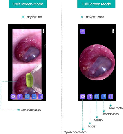 Ear Camera Endoscope 3.9mm - Digital Ear Inspector Compatible with Android and iPhone
