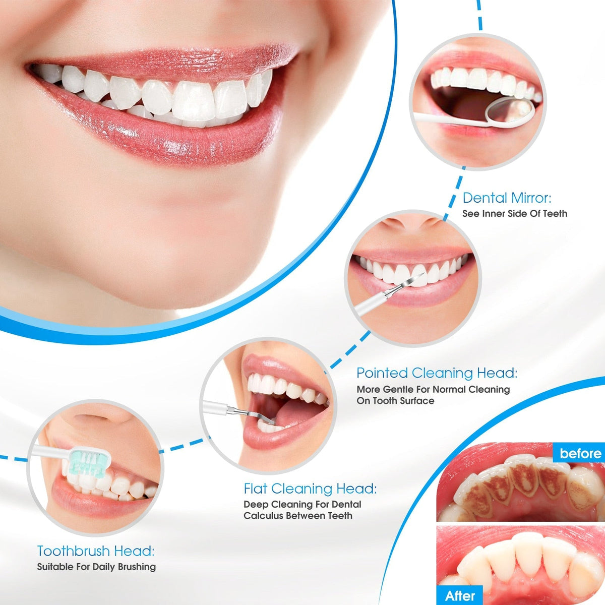 Electric Tooth Cleaner - Remove Tartar Scaler Teeth Cleaner Tool